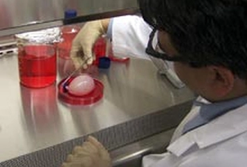 Yapay Mesane Belirtileri ve Tedavisi Yapay Mesane Belirtileri ve Tedavisi