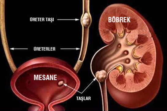 Mesane drar Torbas